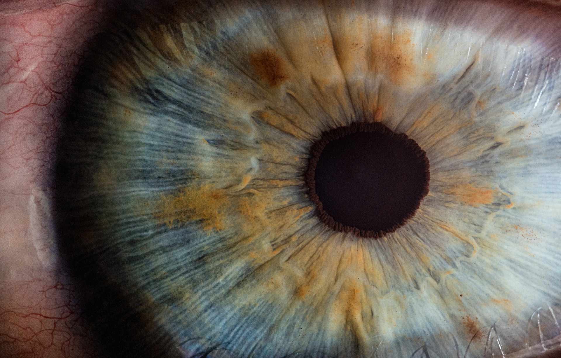 Augenkrankheiten - Übersicht . Liste
